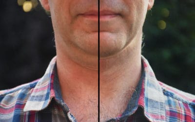 How to Remove a Double Chin in Photoshop